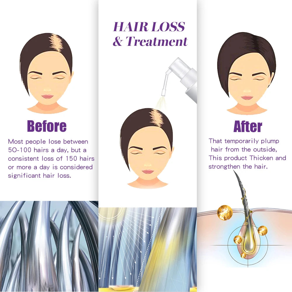 Hair Rapid Growth Essence Oil Anti Hair Loss Dense