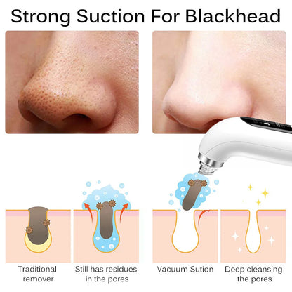 Blackhead Remover Pore Face Cleaner USB Rechargeable