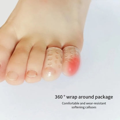 10Pcs Silicone Toe Caps Anti-Friction Breathable Toe Protector